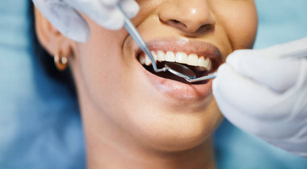 Best Emergency Gum Treatment in Pendleton, IN