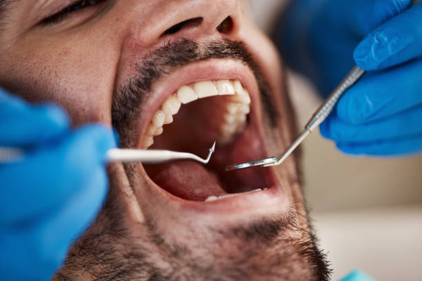 Best Pediatric Emergency Dentist in Pendleton, IN